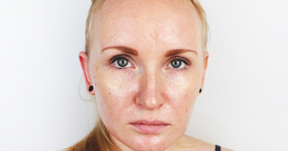Osetljiva koža: vodič za negu